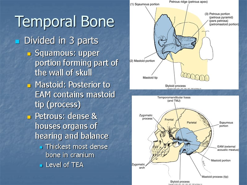 Temporal Bone Divided in 3 parts Squamous: upper portion forming part of the wall